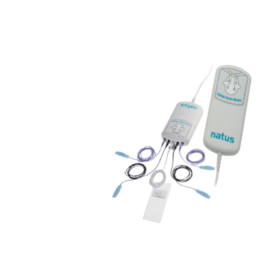 ELECTROENCEFALOGRAFIA AMPLIADA OBM - EEGa