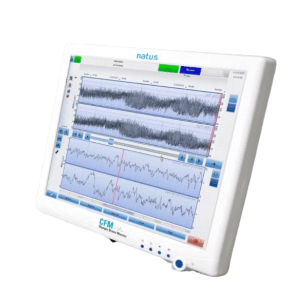 ELECTROENCEFALOGRAFIA AMPLIADA OBM - EEGa