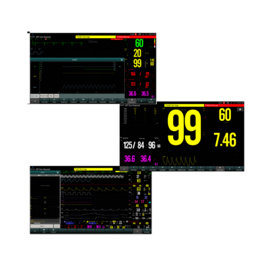 Monitor Modular P12 Biolight | Precisión Neonatal y Versatilidad Clínica