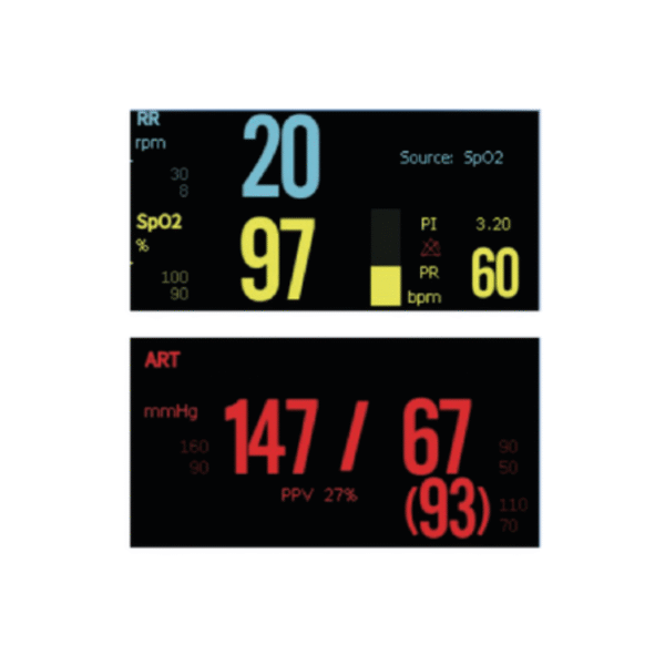 Monitor de Paciente Biolight M12 | Precisión y Rendimiento Clínico Compacto