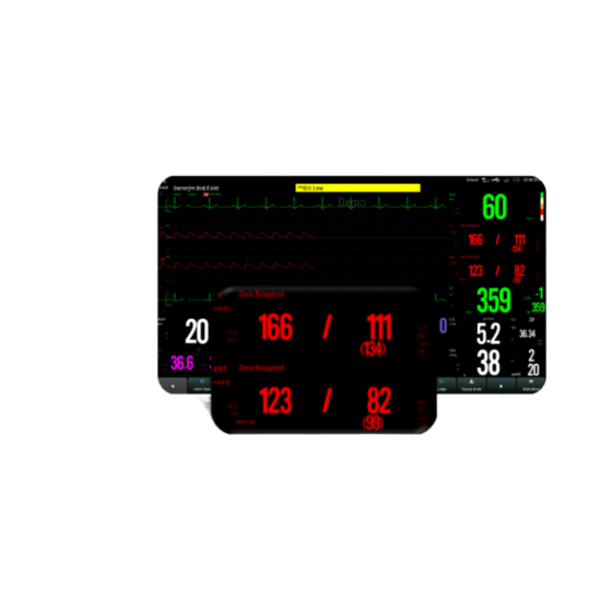 Monitor de Paciente Biolight S12 | Monitoreo Avanzado con Tecnología IoT